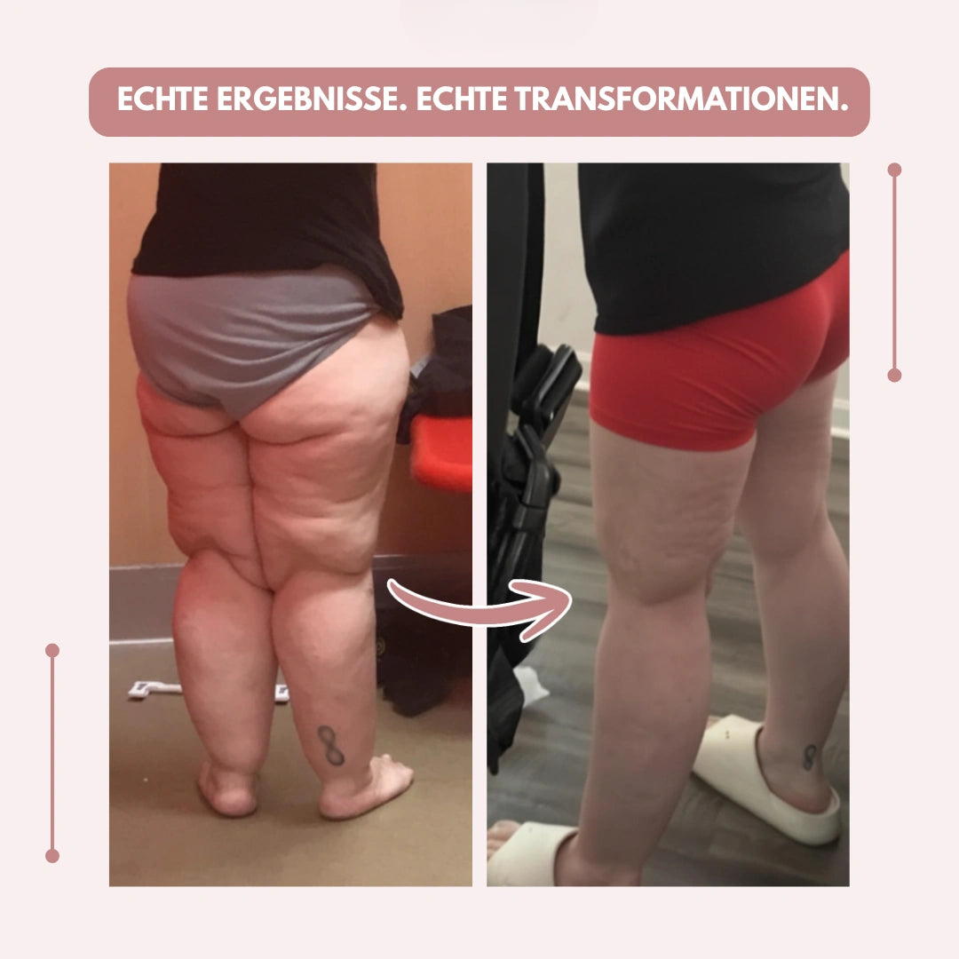 Két egymás melletti fotó hátulról: balra a modell szürke fehérneműben, jobbra piros rövidnadrágban, a lábak előtte-utána összehasonlítása. 10