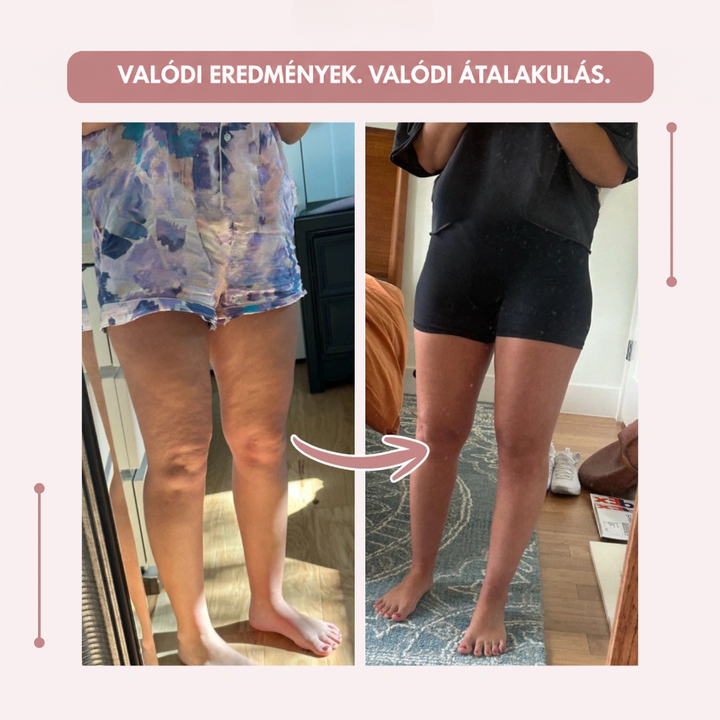Tükörben készült előtte-utána fotópár: bal oldalon mintás pizsamanadrág, jobb oldalon fekete testhezálló rövidnadrág viselete. 19