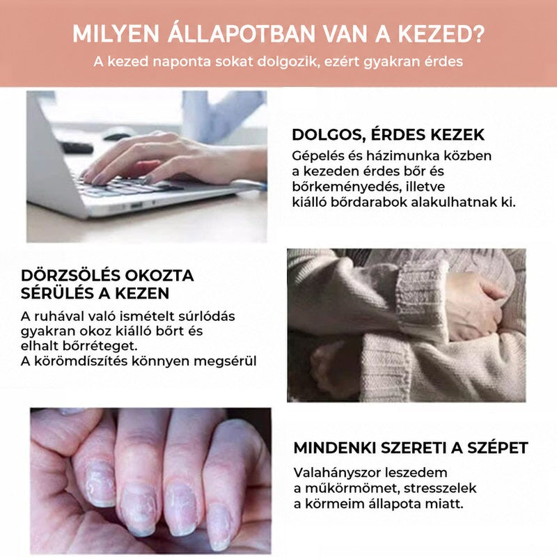 Három jelenet a kéz igénybevételéről: gépelés laptopon, pulóver súrlódása és sérült, hámló körmök közelről 6