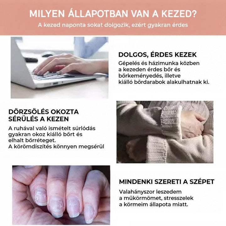 Három jelenet a kéz igénybevételéről: gépelés laptopon, pulóver súrlódása és sérült, hámló körmök közelről 6