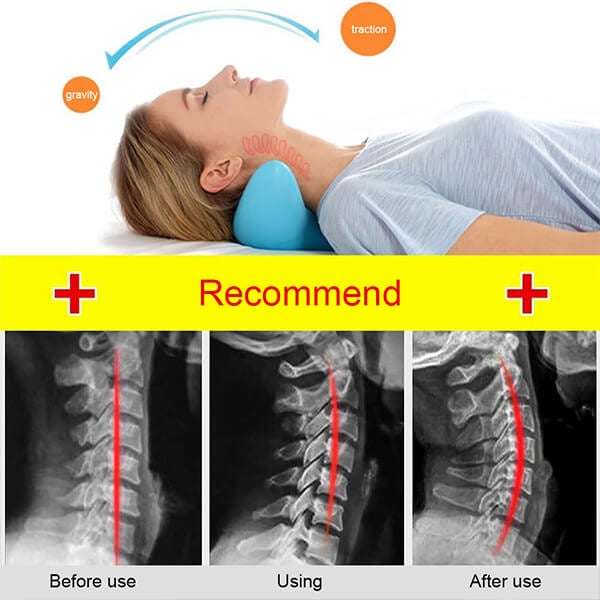 Ergonomikus Nyaknyújtó Párna Áram Nélkül – NeckEase Stretch